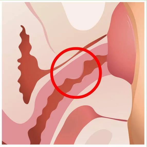 Where is the female G-spot? What is a G-spot orgasm?