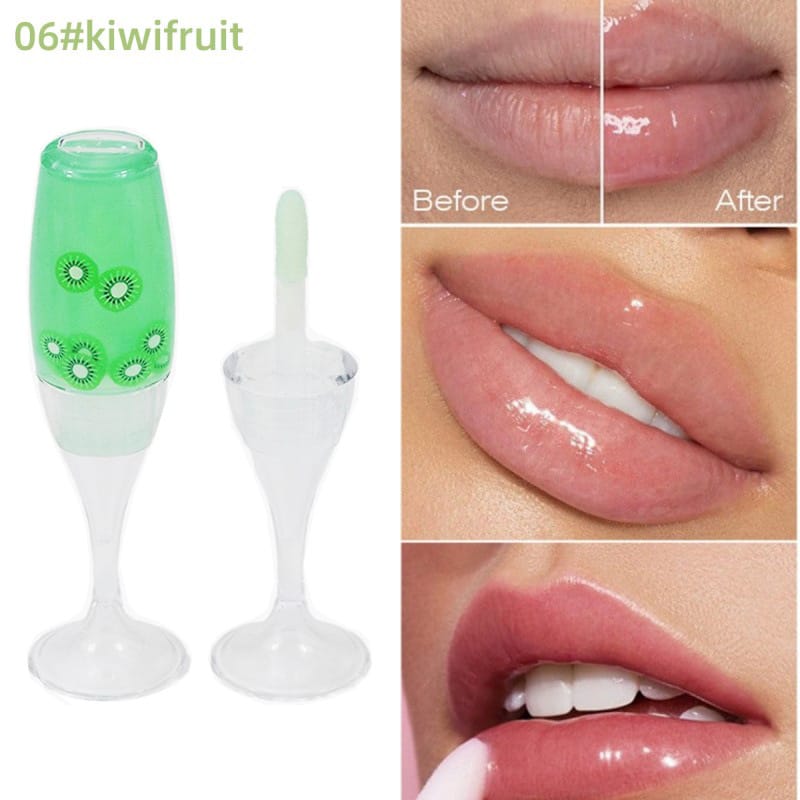 Kiwifruit