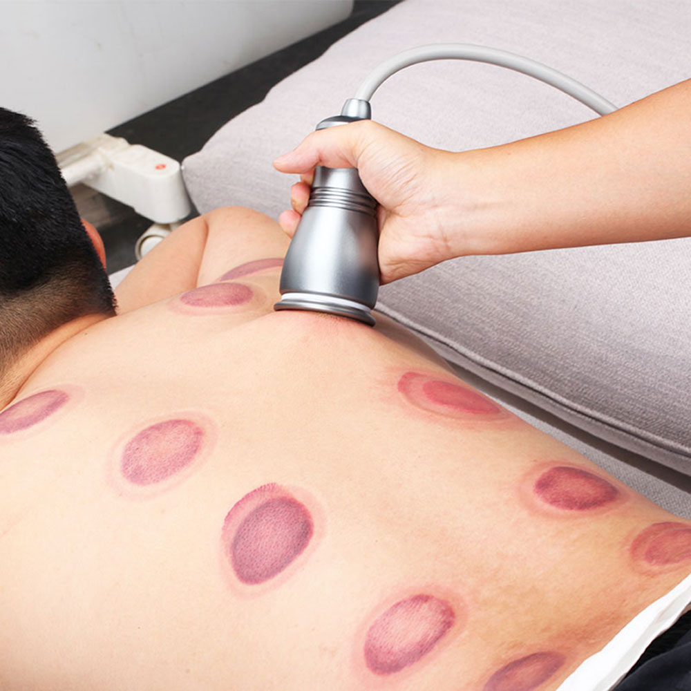 Electric Scraping Machine Body Cupping Massage Gua Sha Ventosas  Anti Cellulite Fat Burner Vacuum Suction Pumps Therapy Apparatus