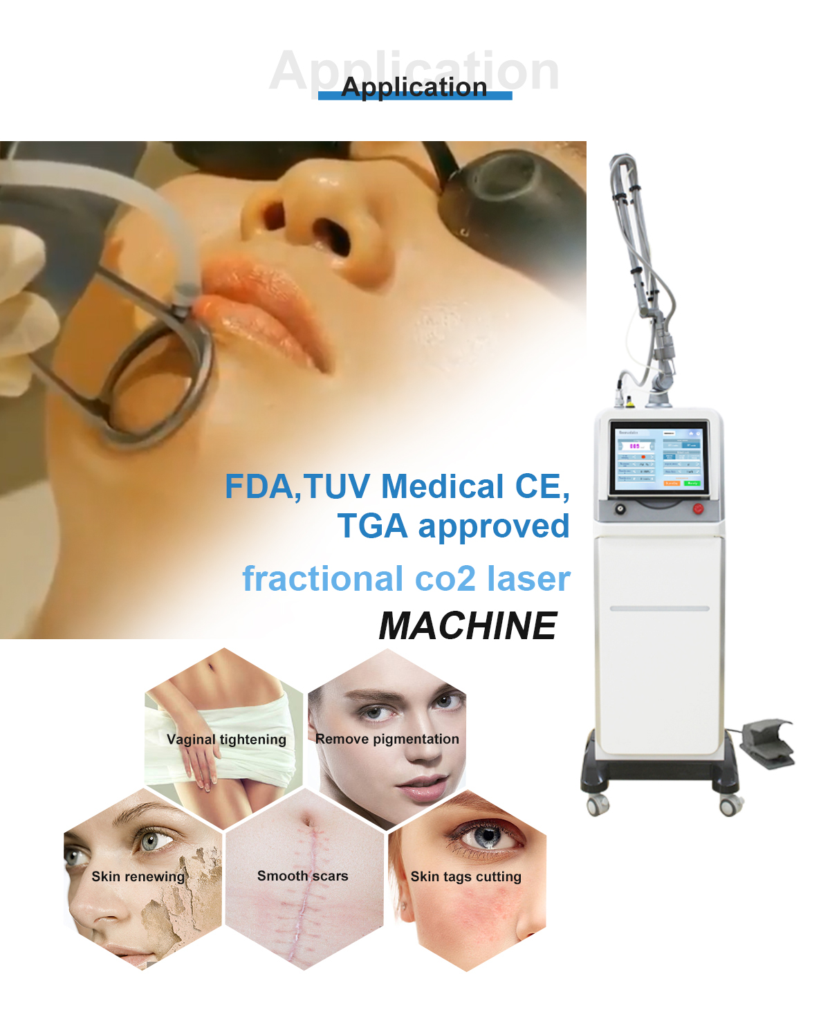 FDA approved Fractional CO2 Laser FDA approved Fractional CO2 Laser