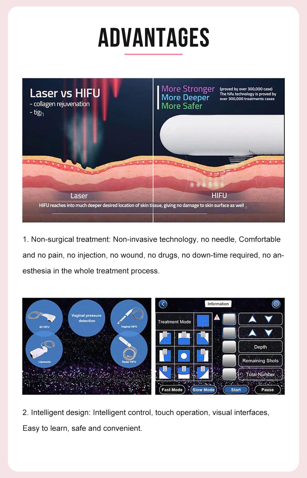 9D HIFU (4D HIFU+Vmax+Liposonix+Vaginal HIFU+Vaginal Test) 9D HIFU (4D HIFU+Vmax+Liposonix+Vaginal HIFU+Vaginal Test)
