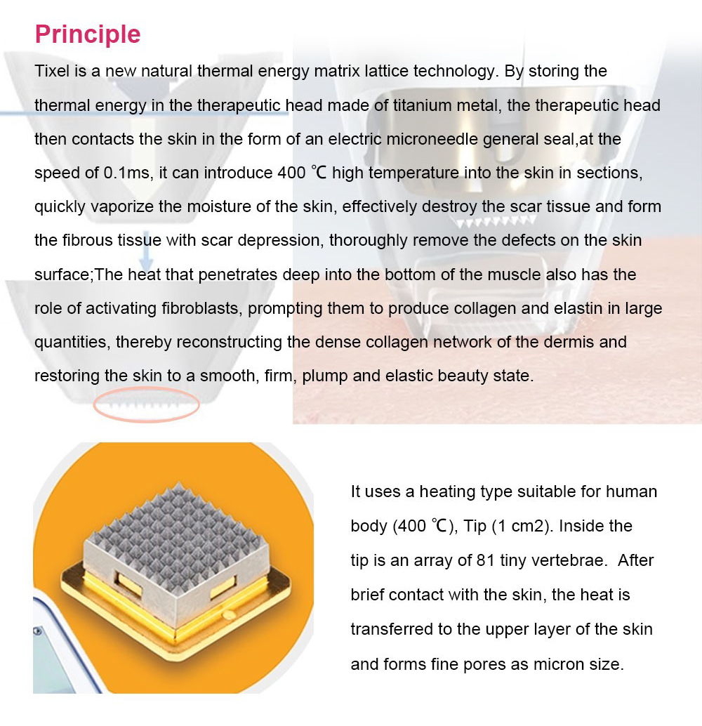 Tixel- new energy lattice skin repair system
