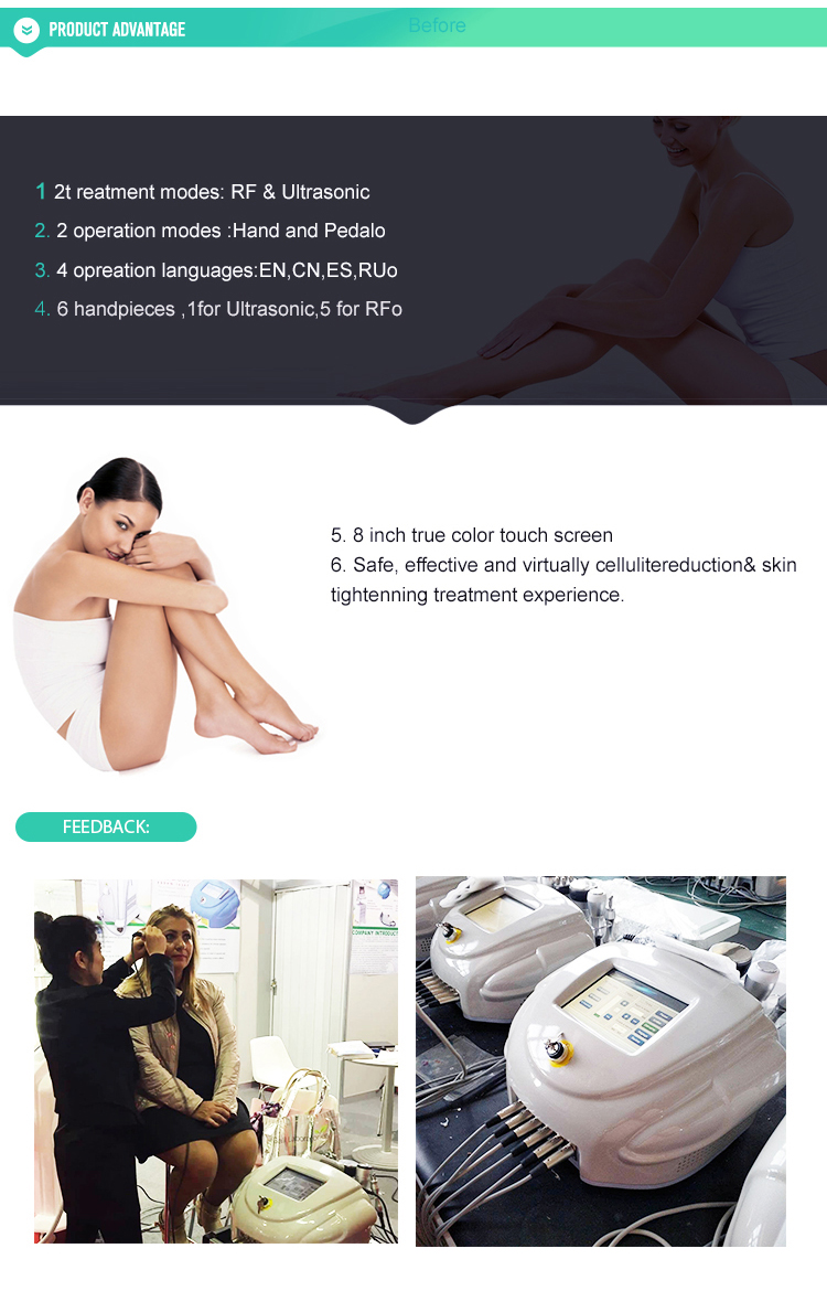 Ultrabox Cacitation RF Body Slimming Skin Care Machine