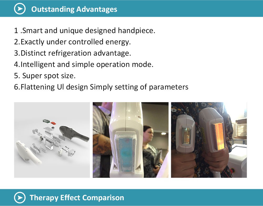 Portable IPL SHR machine