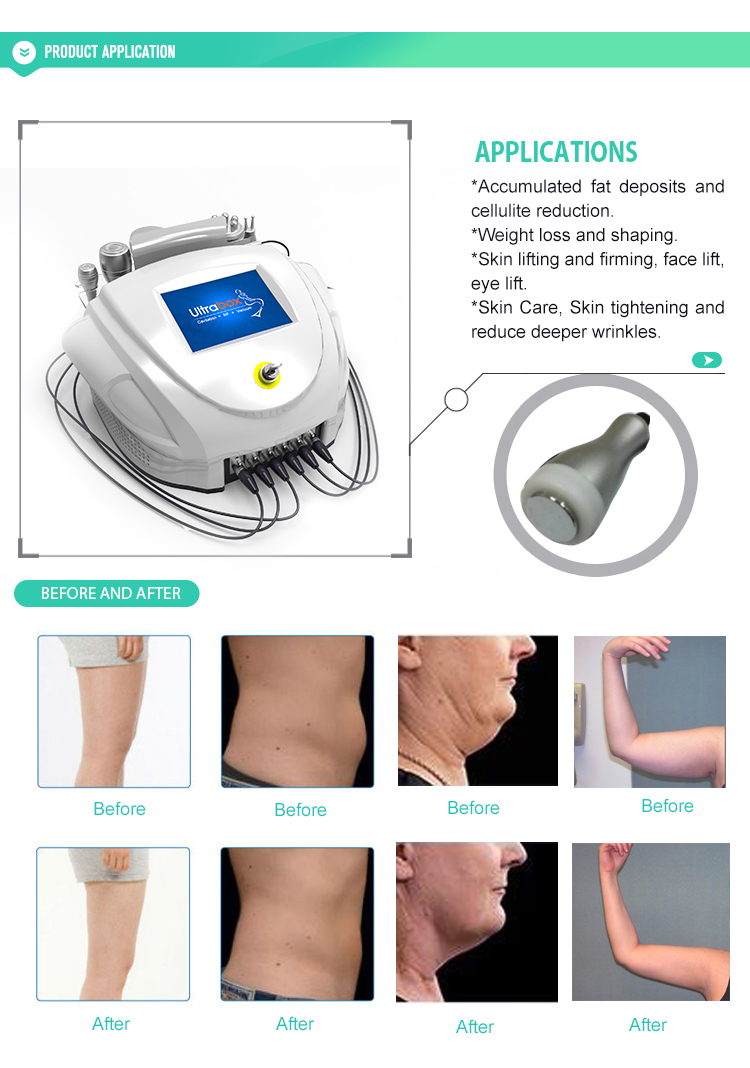 Ultrabox Cacitation RF Body Slimming Skin Care Machine