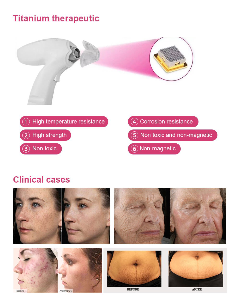 Neo face skin redurfacing machine