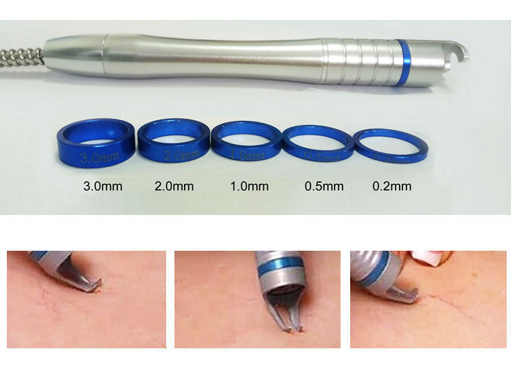 980 nm Spider Vein Removal Machine 980 nm Spider Vein Removal Machine