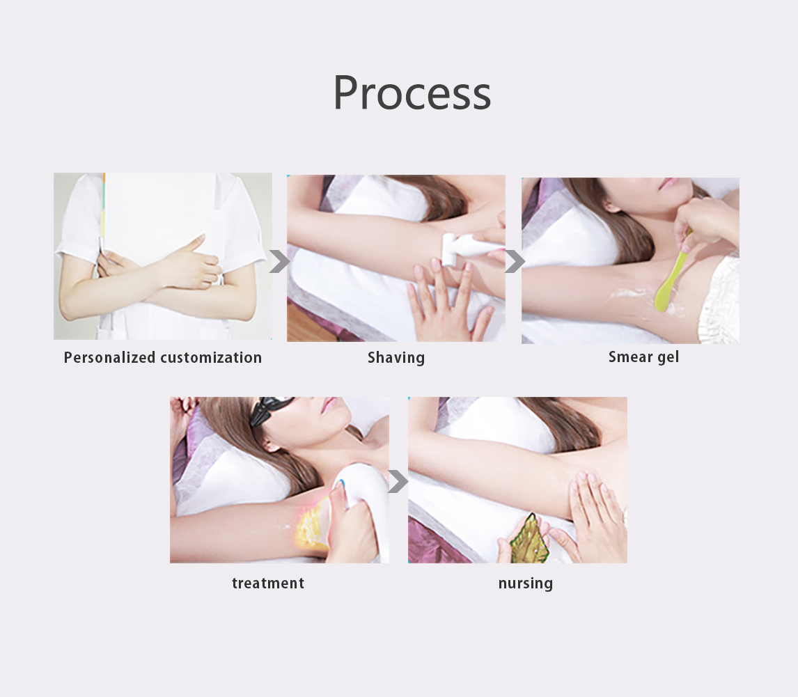 Almar Diode Laser Hair Removal Almar Diode Laser Hair Removal