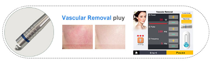 980 nm Spider Vein Removal Machine 980 nm Spider Vein Removal Machine