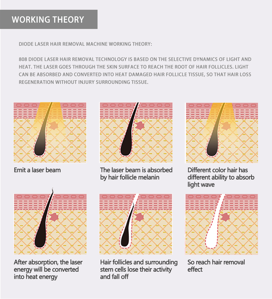 Almar Diode Laser Hair Removal Almar Diode Laser Hair Removal