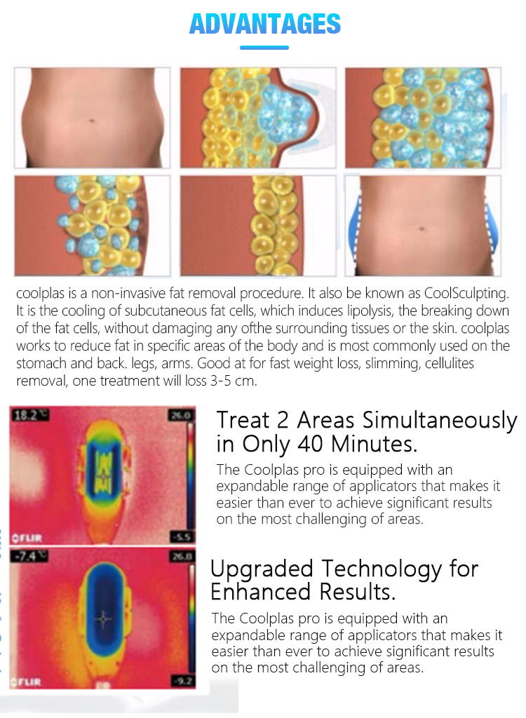 360° Cryolipolysis Fat Freezing machine
