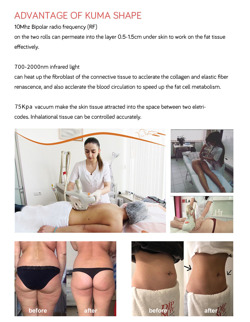 Newest KUMA Pro Body shape machine Newest KUMA Pro Body shape machine