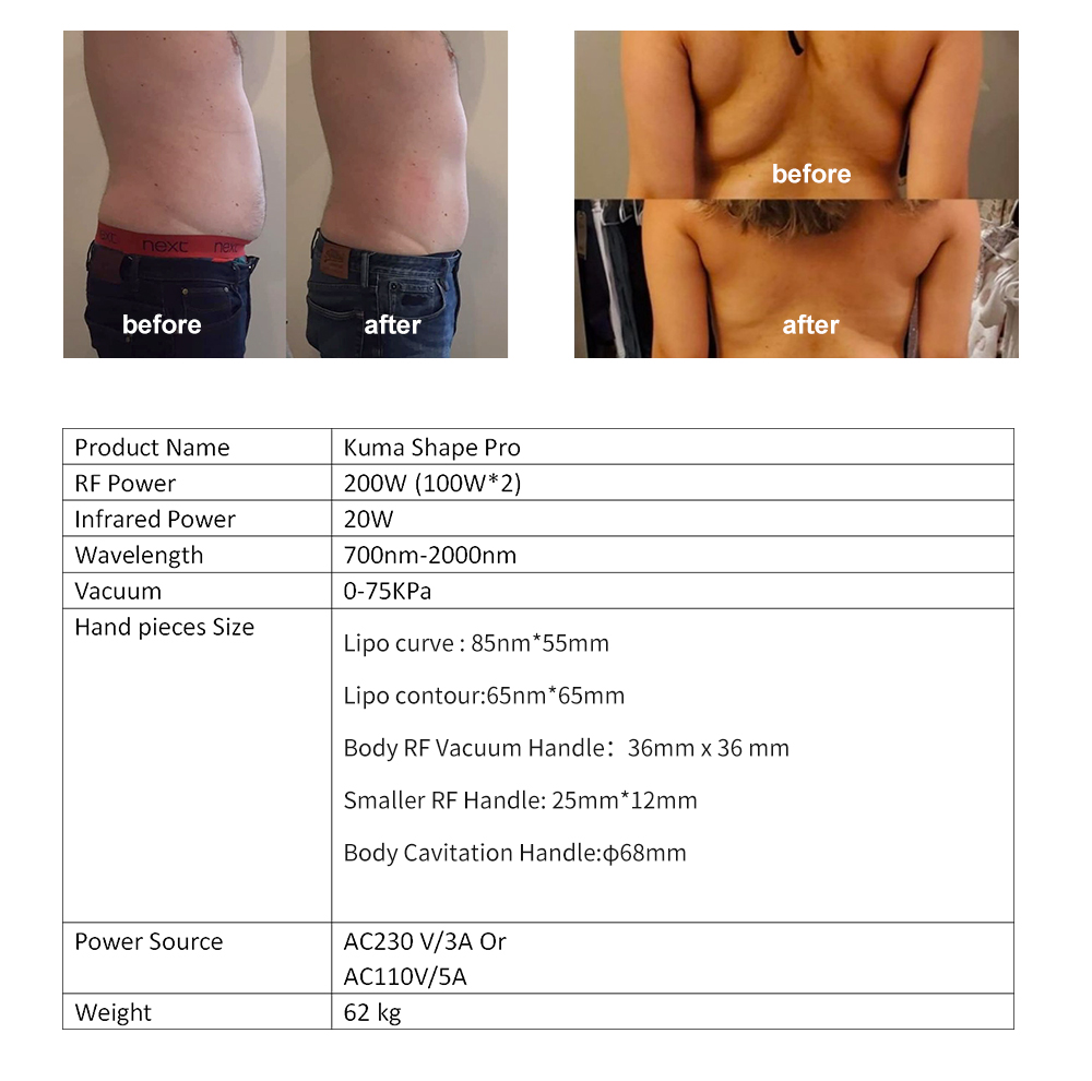 Newest KUMA Pro Body shape machine Newest KUMA Pro Body shape machine