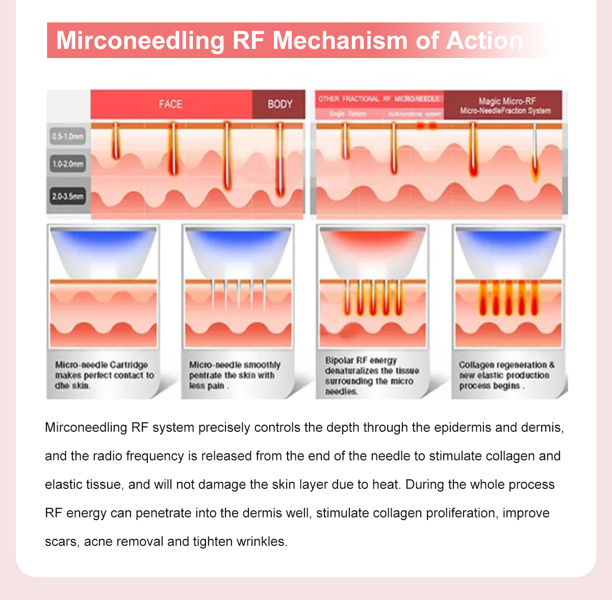 10D HIFU (4D HIFU+Vmax+Liposonix+Vaginal HIFU+Vaginal Test+Mirconeedling RF) 10D HIFU (4D HIFU+Vmax+Liposonix+Vaginal HIFU+Vaginal Test+Mirconeedling RF)