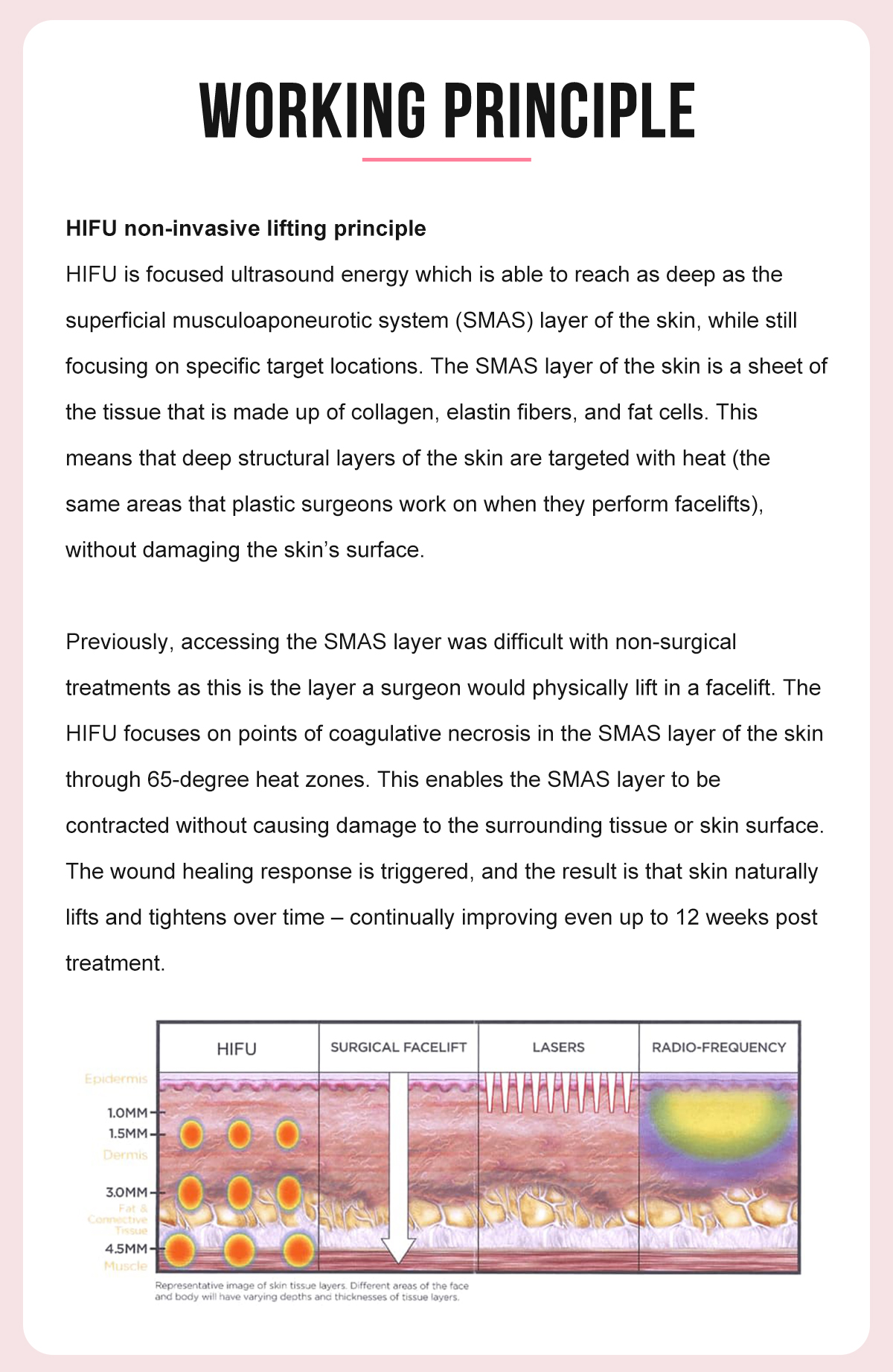 3 IN 1 HIFU Ultrasonic face and body shaping machine (4D HIFU + Radar HIFU+ Vagina HIFU) 3 IN 1 HIFU Ultrasonic face and body shaping machine (4D HIFU + Radar HIFU+ Vagina HIFU)
