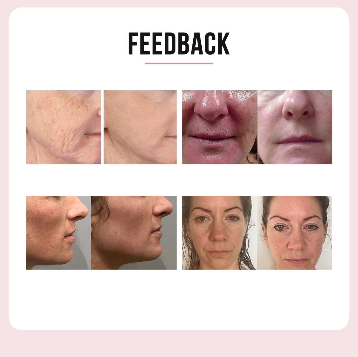 3 IN 1 HIFU Ultrasonic face and body shaping machine (4D HIFU + Radar HIFU+ Vagina HIFU) 3 IN 1 HIFU Ultrasonic face and body shaping machine (4D HIFU + Radar HIFU+ Vagina HIFU)