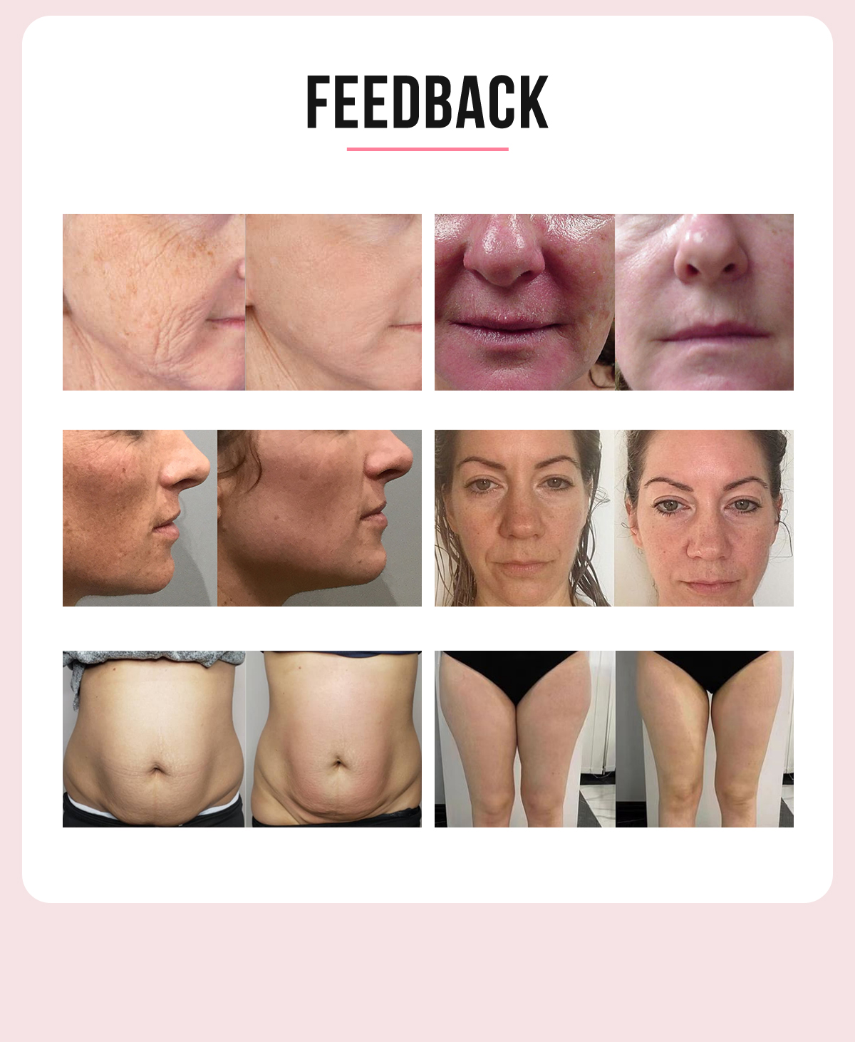 3 IN 1 HIFU Ultrasonic face and body shaping machine (4D HIFU + Radar HIFU+ liposonix) 3 IN 1 HIFU Ultrasonic face and body shaping machine (4D HIFU + Radar HIFU+ liposonix)