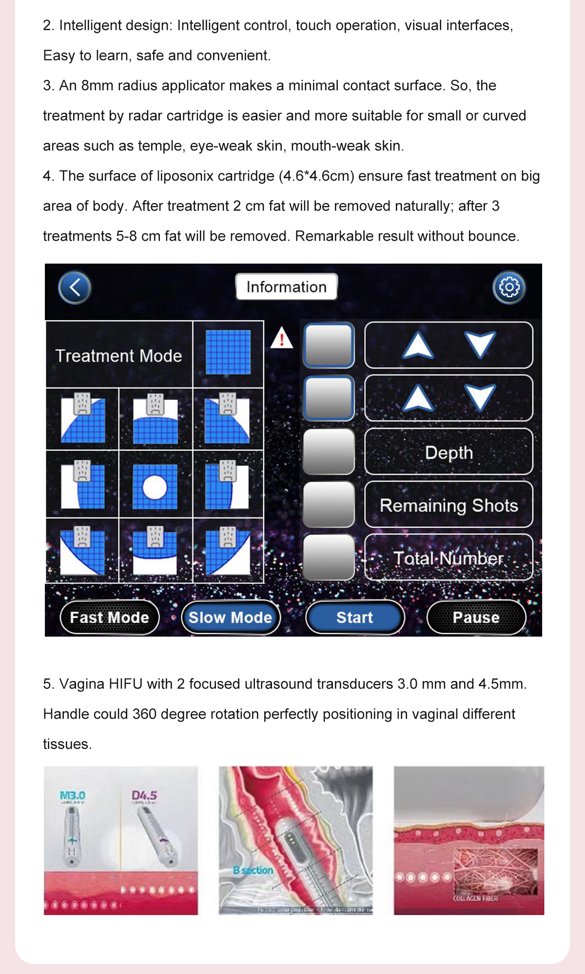 9D HIFU (4D HIFU+Vmax+Liposonix+Vaginal HIFU+Vaginal Test) 9D HIFU (4D HIFU+Vmax+Liposonix+Vaginal HIFU+Vaginal Test)