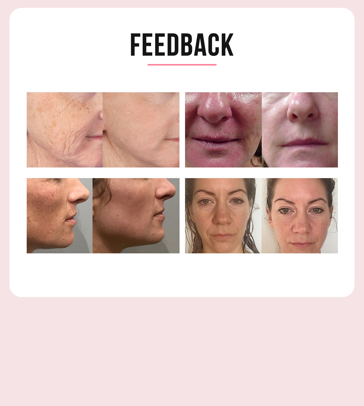 4D HIFU Ultrasonic 12 lines face and body shaping machine 4D HIFU Ultrasonic 12 lines face and body shaping machine