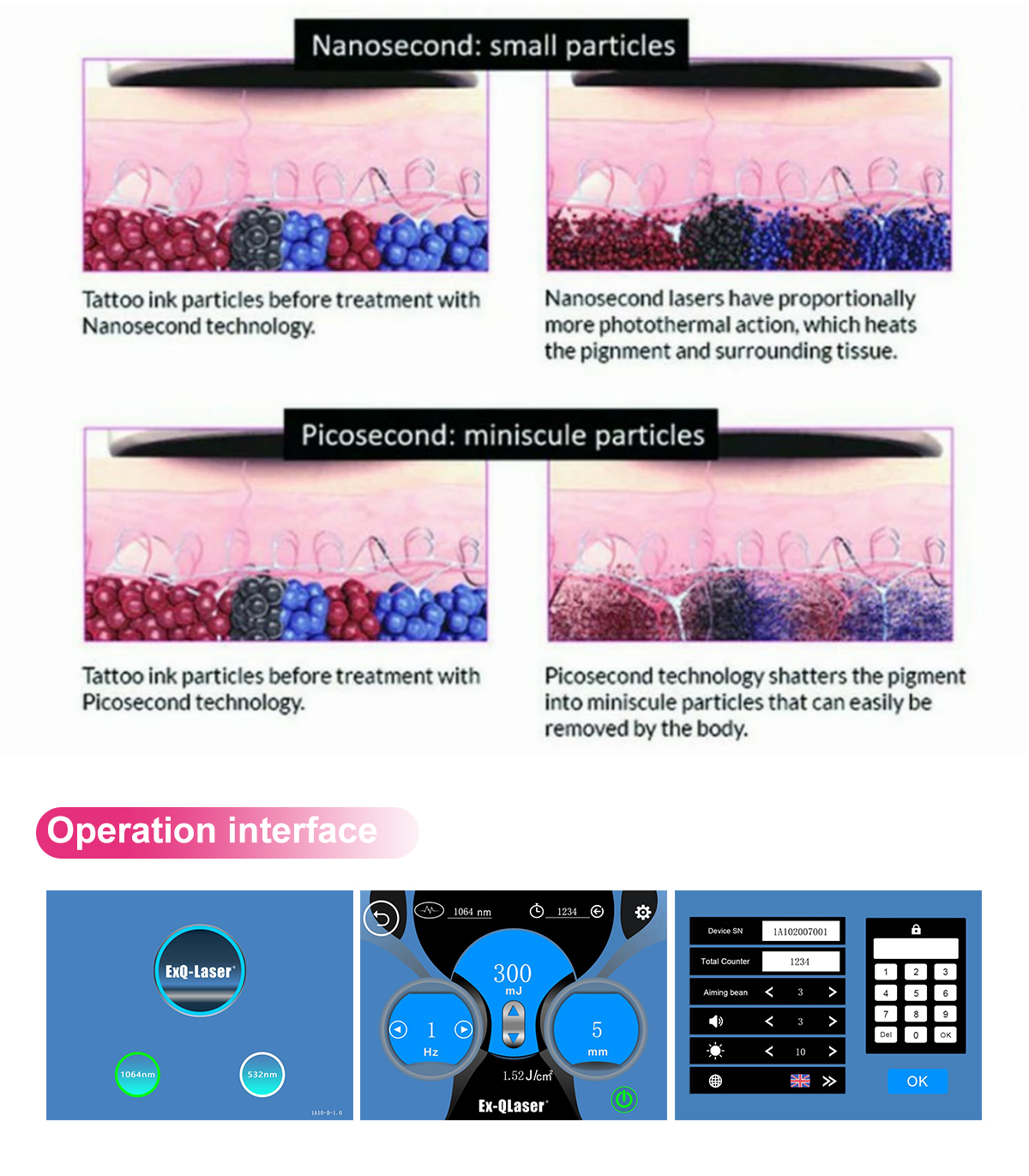 picosecond ND: YAG laser